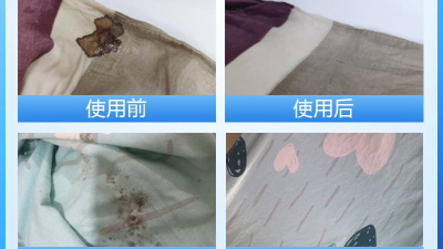 酶制劑在醫療器械清洗劑中的作用，您了解多少？